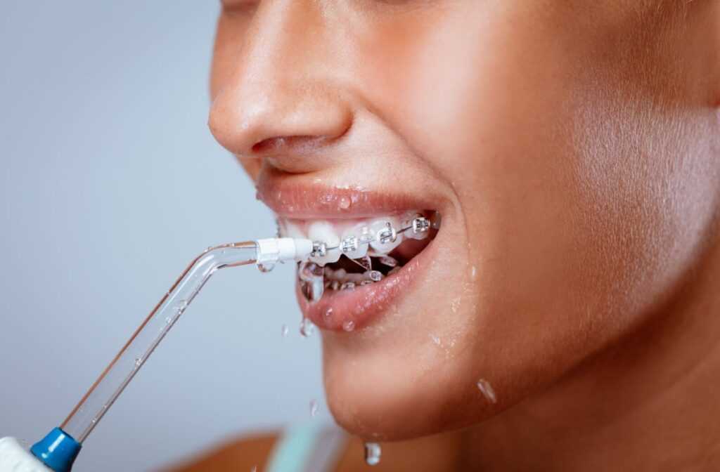 A person with braces opens their mouth to use the water flosser to floss and clean their teeth.